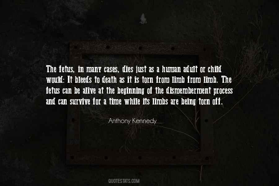 Anthony Kennedy Quotes #1410226