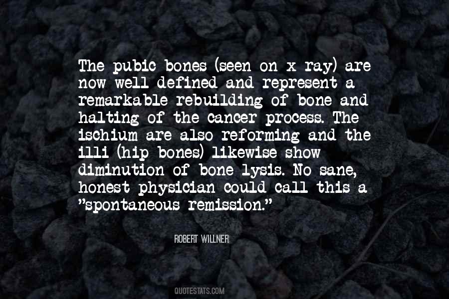 Robert Willner Quotes #65225