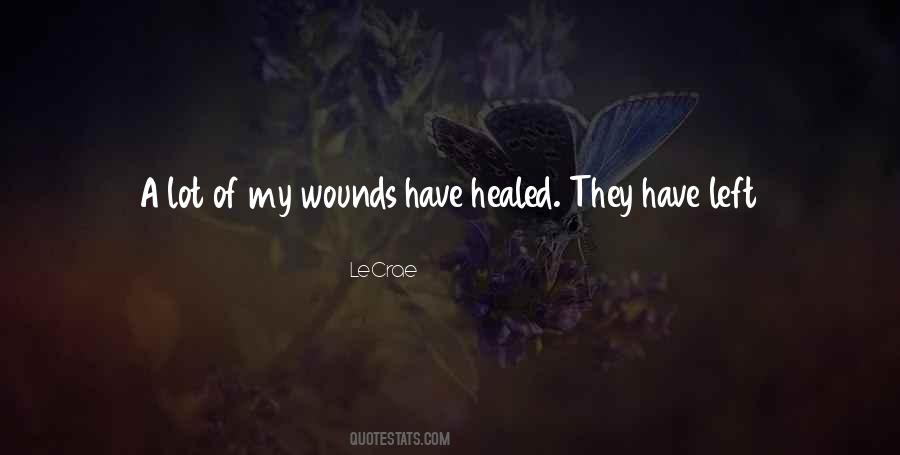 Quotes About Healed Scars #1393952