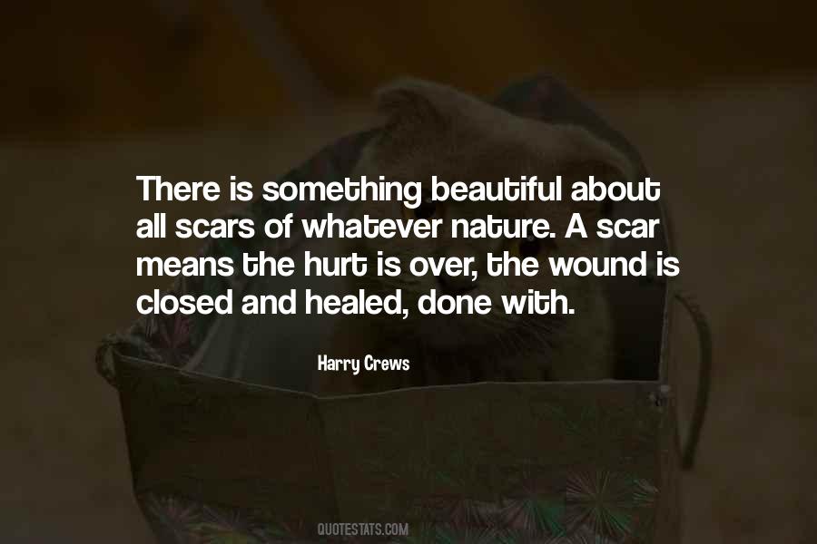 Quotes About Healed Scars #1756180