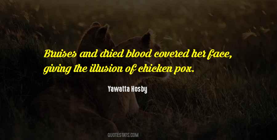 Quotes About Chicken Pox #1233728