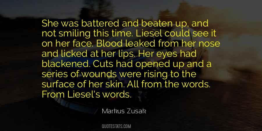 Quotes About Battered #1818143
