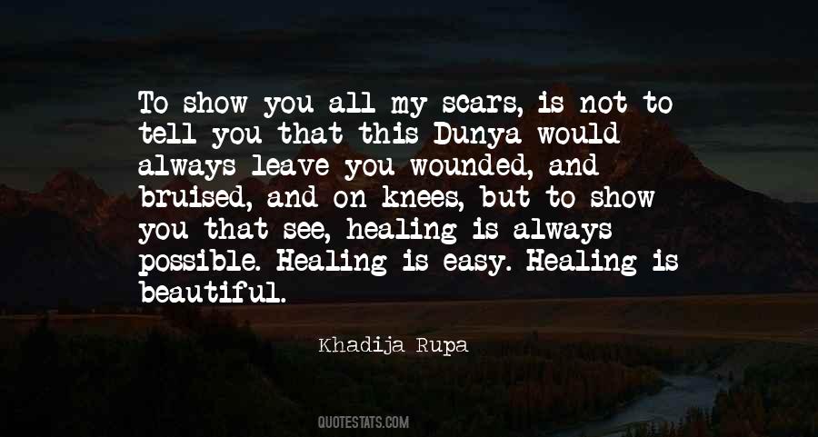 Quotes About Scars #1349817