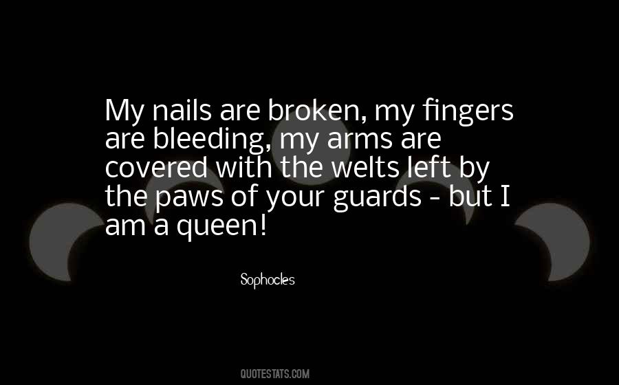 Quotes About Broken Fingers #794521
