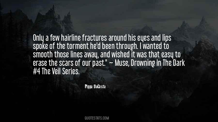 Quotes About Fractures #164830