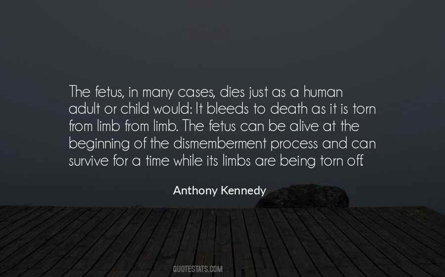 Quotes About When A Child Dies #1410226