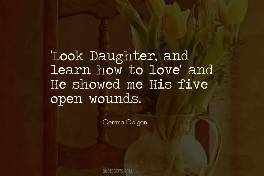 Quotes About Open Wounds #738707