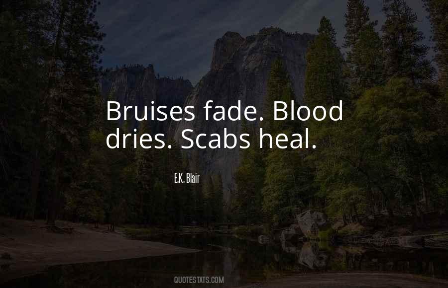 Bruises Heal Quotes #1460207