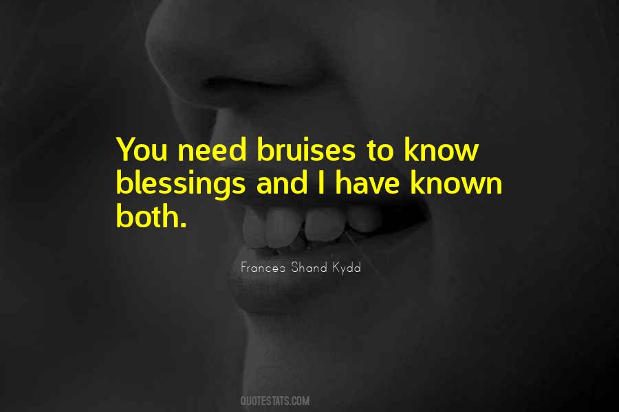 I Need You More Than You Will Ever Know Quotes #54346