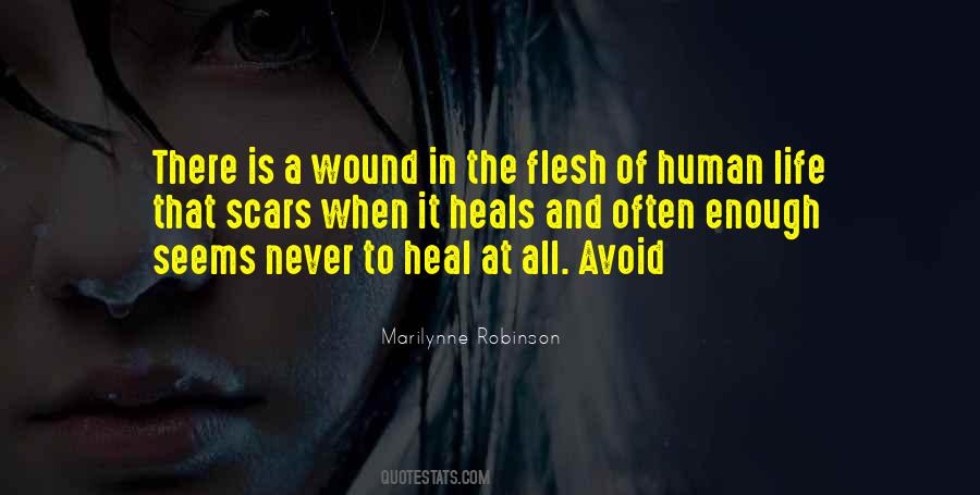 Some Scars Never Heal Quotes #1753725