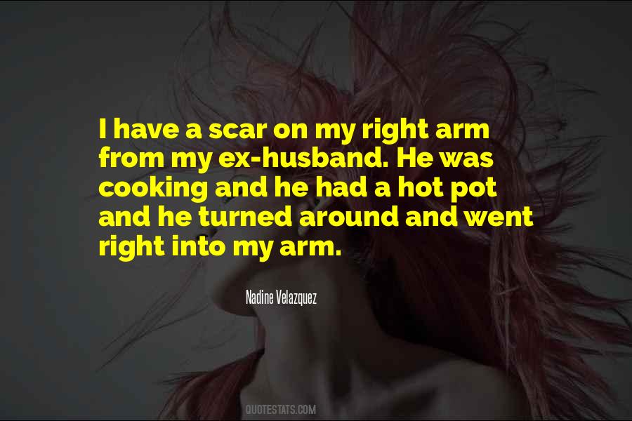 My Right Arm Quotes #1065613