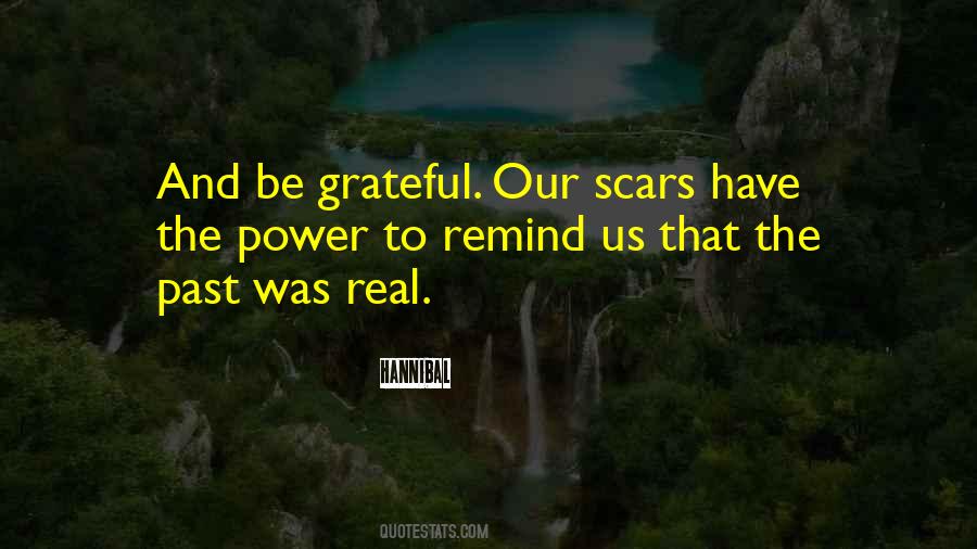 Scars Are There To Remind Us Quotes #1207450