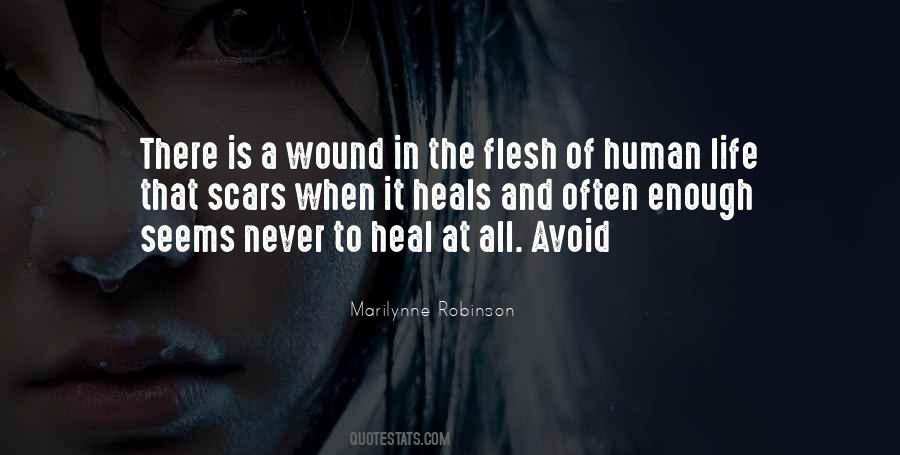 To Heal A Wound Quotes #1753725
