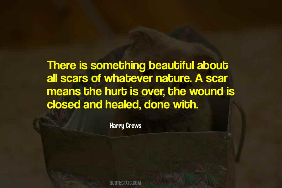 Hurt Scars Quotes #1756180