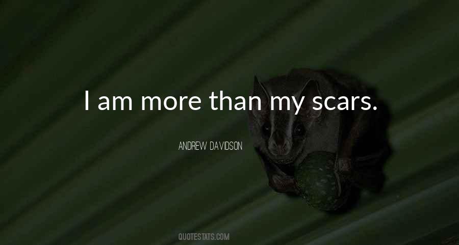 Love My Scars Quotes #1351708