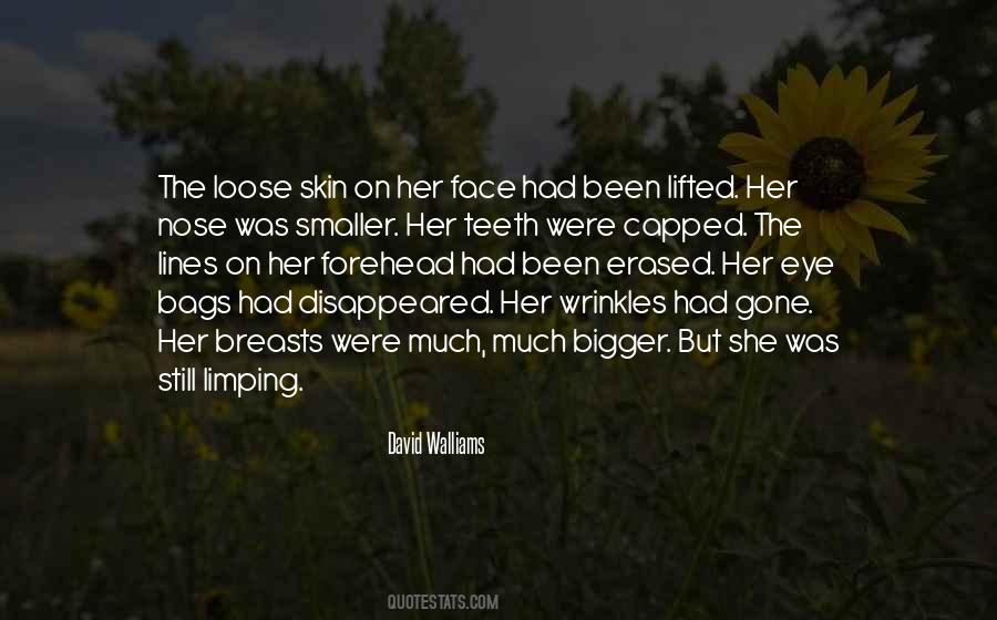 Under Eye Bags Quotes #447530