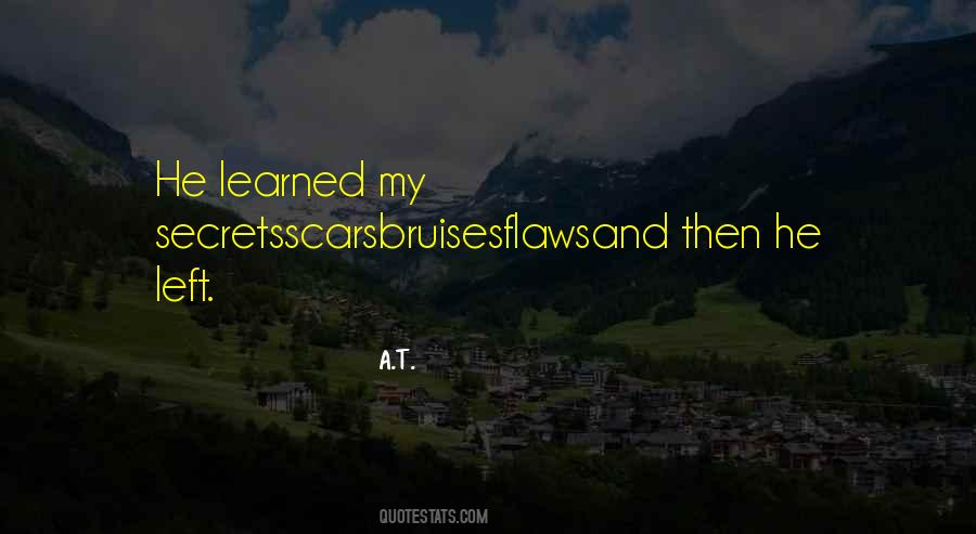 Bruises'n Quotes #457939